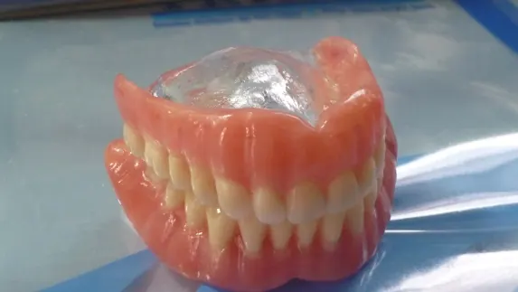 Prótese total acrílica feita no laboratório da Clínica 3G